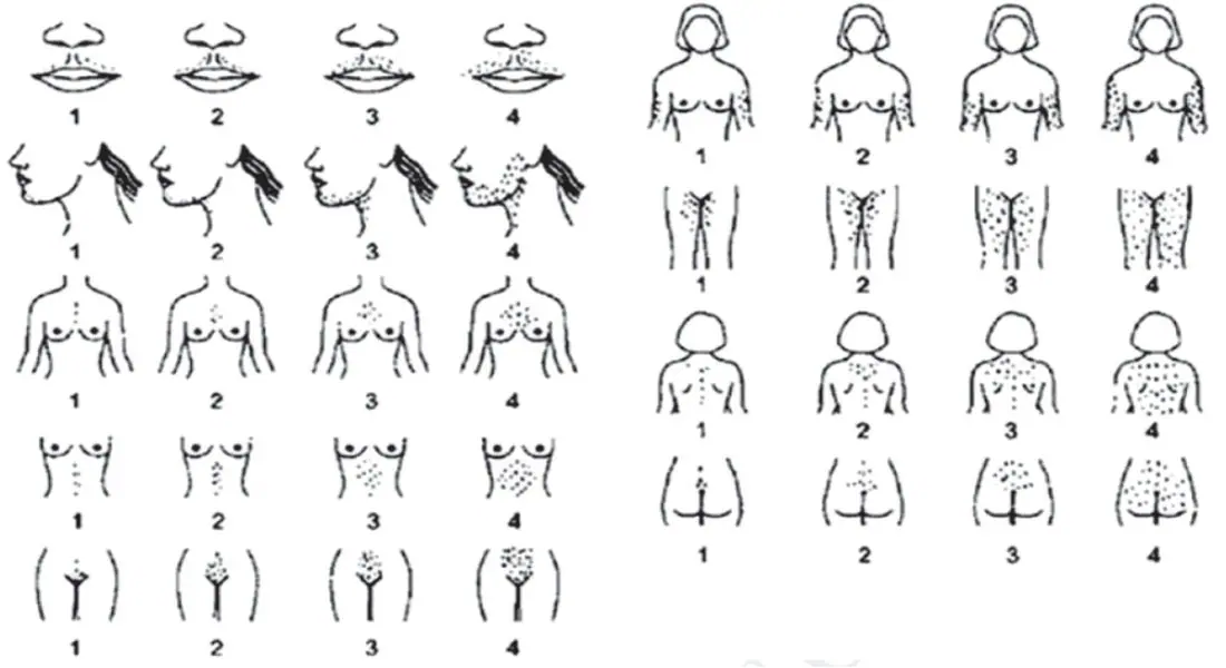 Figura 4 del artículo