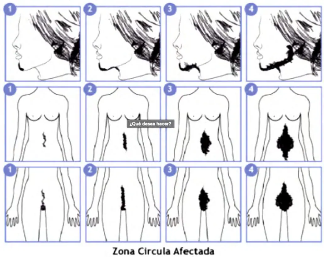 Figura 5 del artículo
