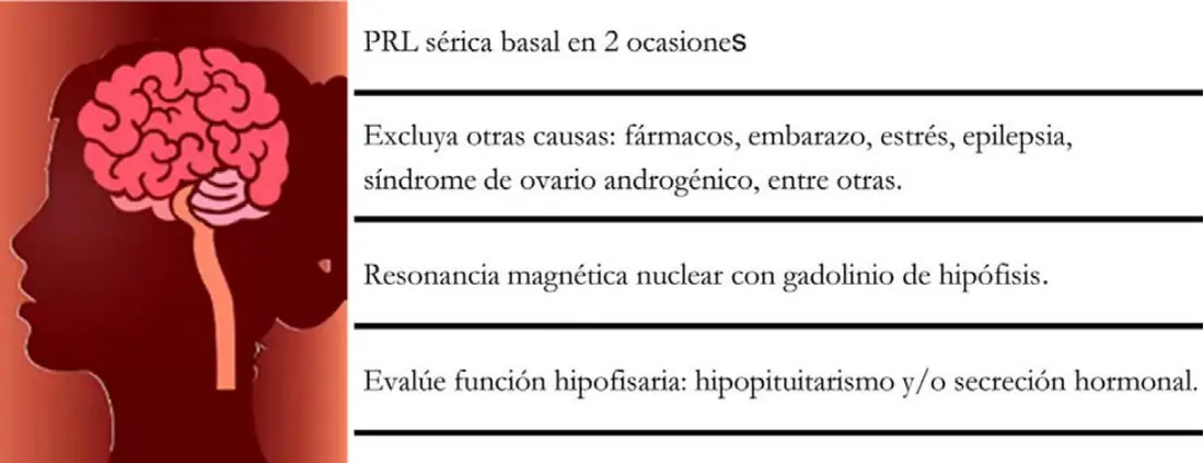 Imagen del artículo
