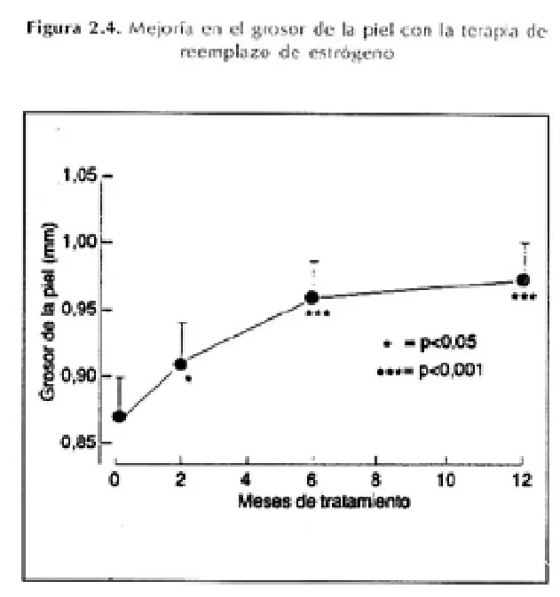 Imagen del artículo